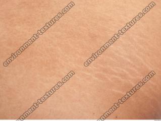 photo texture of scarred skin 0008